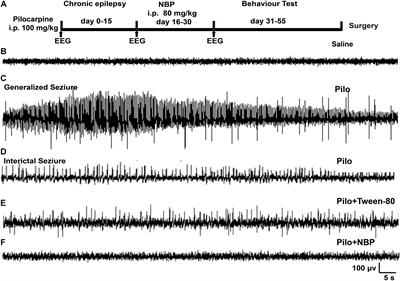 Protective Role of L-3-n-Butylphthalide in Cognitive Function and Dysthymic Disorders in Mouse With Chronic Epilepsy